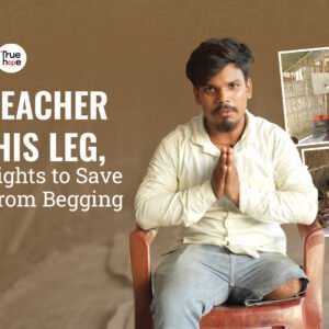 That Accident Took My Leg, But Not My Spirit.